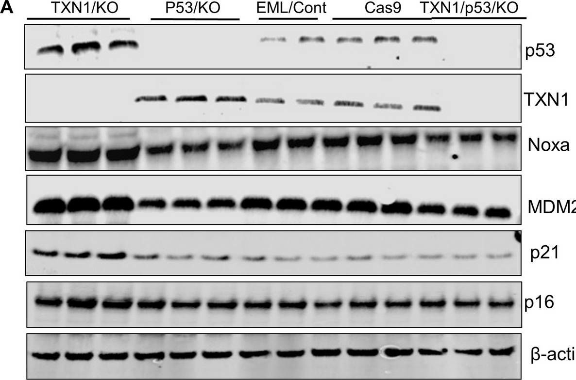 Fig.6.A showing Western Blotting in a Mus musculus (House mouse) sample from the publication: Thioredoxin-1 regulates self-renewal and differentiation of murine hematopoietic stem cells through p53 tumor suppressor.