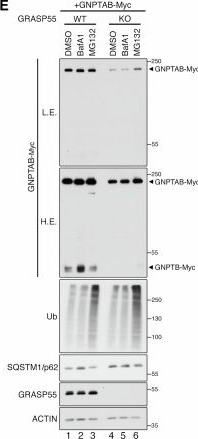Fig.6.E showing Western Blotting from the publication: GRASP55 maintains lysosome function by controlling sorting of lysosomal enzymes at the Golgi.