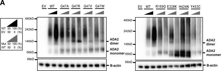 Fig.4.A showing Western Blotting in a Homo sapiens (Human) sample from the publication: Dominant negative ADA2 mutations cause ADA2 deficiency in heterozygous carriers.