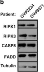 Fig.6.B showing Western Blotting from the publication: Triggering necroptosis in cisplatin and IAP antagonist-resistant ovarian carcinoma.