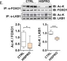 Fig.3.E showing Western Blotting in a Mus musculus (House mouse) sample from the publication: Combined Histidine and Proline Supplementation (HISPRO) Enhances Oxidative and Mitochondrial Function in Skeletal Muscle Through SIRT1-Associated Signaling.