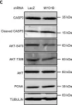 Fig.6.C showing Western Blotting from the publication: Myosin 1b Regulates Nuclear AKT Activation by Preventing Localization of PTEN in the Nucleus.