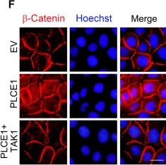 Fig.5.F showing Immunocytochemistry-immunofluorescence from the publication: TAK1-mediated phosphorylation of PLCE1 represses PIP2 hydrolysis to impede esophageal squamous cancer metastasis.