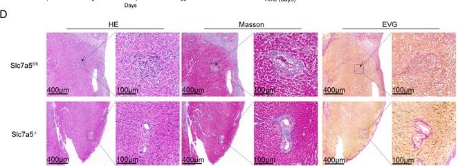 Fig.5.D showing Immunohistochemistry in a Homo sapiens (Human) sample from the publication: Targeting the Mapk13-Tcf1-Slc7a5 Axis via One-Carbon Metabolic Regulation to Prevent Chronic Allograft Vasculopathy.