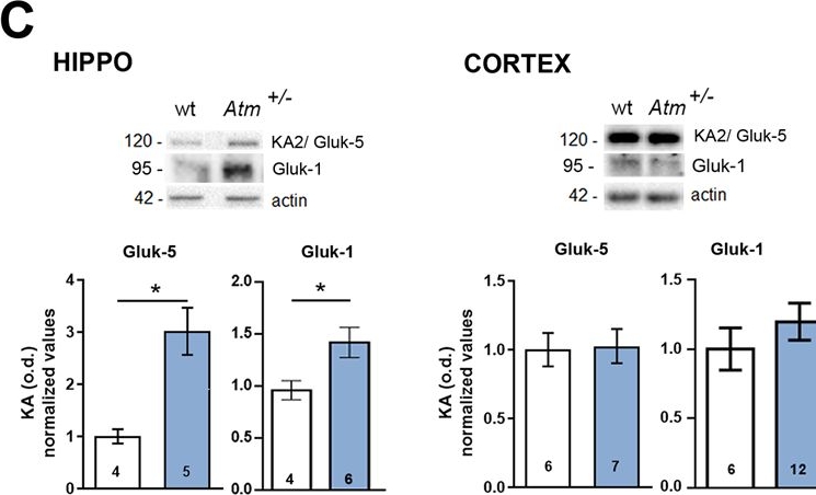 Fig.4.C showing Western Blotting in a Mus musculus (House mouse) sample from the publication: ATM rules neurodevelopment and glutamatergic transmission in the hippocampus but not in the cortex.