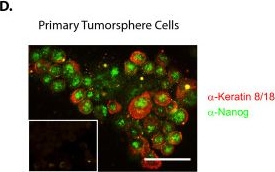 NOTCH1 inhibition in vivo results in mammary tumor regression and reduced mammary tumorsphere-forming activity in vitro.