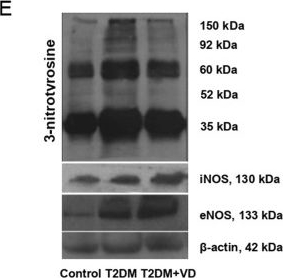 Fig.4.E showing Western Blotting in a Rattus norvegicus (Rat) sample from the publication: Vitamin D3 affects liver expression of pro-/anti-inflammatory cytokines and nitric oxide synthases in type 2 diabetes.