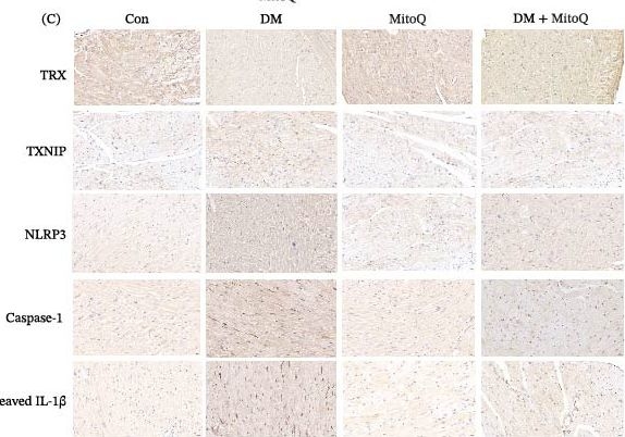 Fig.2.C showing Immunohistochemistry from the publication: MitoQ Ameliorates Diabetic Cardiomyopathy by Inhibiting the mtROS-TXNIP-NLRP3 Pathway.