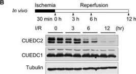 Fig.1.B showing Western Blotting in a Mus musculus (House mouse) sample from the publication: CUEDC2 modulates cardiomyocyte oxidative capacity by regulating GPX1 stability.