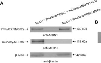 Fig.1.A showing Western Blotting from the publication: Chemical Targeting of the ATXN1 aa99-163 Interaction Site Suppresses polyQ-Expanded Protein Dimerization.