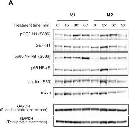 Fig.1.A showing Western Blotting from the publication: Pro-Inflammatory Macrophage Phenotype Skewing Induced by Tumor Treating Fields (TTFields).