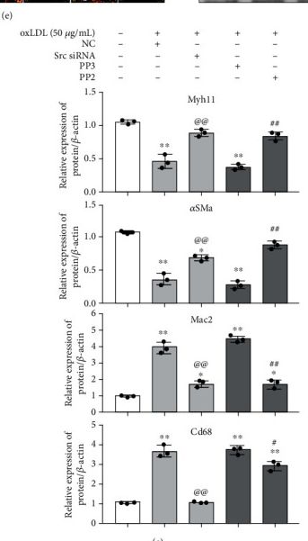 Fig.5.E from the publication: Toll-Like Receptor 4 Mediated Oxidized Low-Density Lipoprotein-Induced Foam Cell Formation in Vascular Smooth Muscle Cells via Src and Sirt1/3 Pathway.