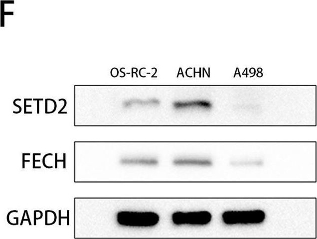 Fig.7.F showing Western Blotting in a Homo sapiens (Human) sample from the publication: Knockdown of SETD2 promotes erastin-induced ferroptosis in ccRCC.