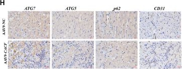 Fig.7.H showing Immunohistochemistry in a Rattus norvegicus (Rat) sample from the publication: LncRNA CACF promotes autophagy and cardiac recovery after myocardial infarction by targeting ATG7.
