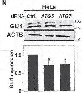 Fig.1.N showing Western Blotting from the publication: ULK3-dependent activation of GLI1 promotes DNMT3A expression upon autophagy induction.
