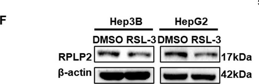 Fig.8.F showing Western Blotting in a Homo sapiens (Human) sample from the publication: Highly expressed RPLP2 inhibits ferroptosis to promote hepatocellular carcinoma progression and predicts poor prognosis.