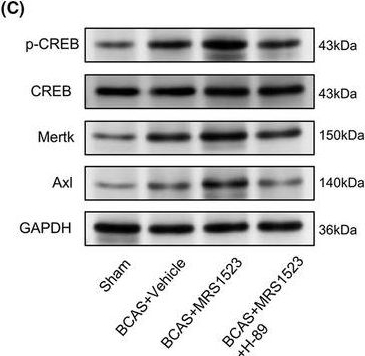 Fig.5.C showing Western Blotting from the publication: Inhibition of ADORA3 promotes microglial phagocytosis and alleviates chronic ischemic white matter injury.