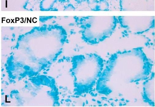 Fig.2.T showing Immunohistochemistry in a Homo sapiens (Human) sample from the publication: High IL-10 mRNA levels in regional lymph nodes of colon cancer patients indicate poor prognosis.