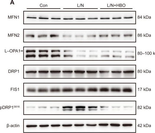 Fig.3.A showing Western Blotting in a Mus musculus (House mouse) sample from the publication: Hyperbaric Oxygen Attenuates Cerebral Ischemia-Reperfusion Injury Through ROS-Dependent Remodeling of Microglial Mitochondrial Dynamics.