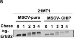 Fig.2.B showing Western Blotting in a Homo sapiens (Human) sample from the publication: CHIP/STUB1 Ubiquitin Ligase Functions as a Negative Regulator of ErbB2 by Promoting Its Early Post-Biosynthesis Degradation.