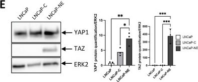 Fig.6.E showing Western Blotting in a Homo sapiens (Human) sample from the publication: Primary Cilium Forces Neuroendocrine Shift in Prostate Cancer through YAP1 Repression and Reduced Mitochondrial Activity.
