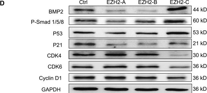 Fig.4.D showing Western Blotting in a Homo sapiens (Human) sample from the publication: Alternative splicing of EZH2 regulated by SNRPB mediates hepatocellular carcinoma progression via BMP2 signaling pathway.