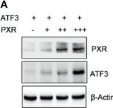 Fig.2.A showing Western Blotting in a Homo sapiens (Human) sample from the publication: Nuclear Receptor PXR Confers Irradiation Resistance by Promoting DNA Damage Response Through Stabilization of ATF3.
