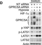 Fig.4.D showing Western Blotting from the publication: Cancer cell adaptation to hypoxia involves a HIF-GPRC5A-YAP axis.