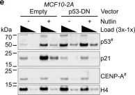 Fig.3.E showing Western Blotting from the publication: CENP-A overexpression promotes distinct fates in human cells, depending on p53 status.