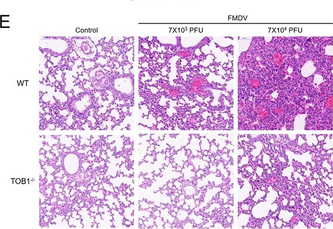 Fig.7.E showing Immunohistochemistry in a Mus musculus (House mouse) sample from the publication: A genome-wide CRISPR screening uncovers that TOB1 acts as a key host factor for FMDV infection via both IFN and EGFR mediated pathways.