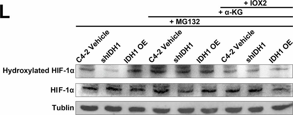 Fig.5.L showing Western Blotting from the publication: c-Fos-driven metabolic switch of α-ketoglutarate orchestrates progression in prostate cancer.
