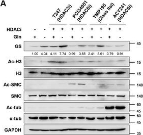 Fig.1.A showing Western Blotting from the publication: HDAC6 and USP9X Control Glutamine Metabolism by Stabilizing GS to Promote Glioblastoma Tumorigenesis.