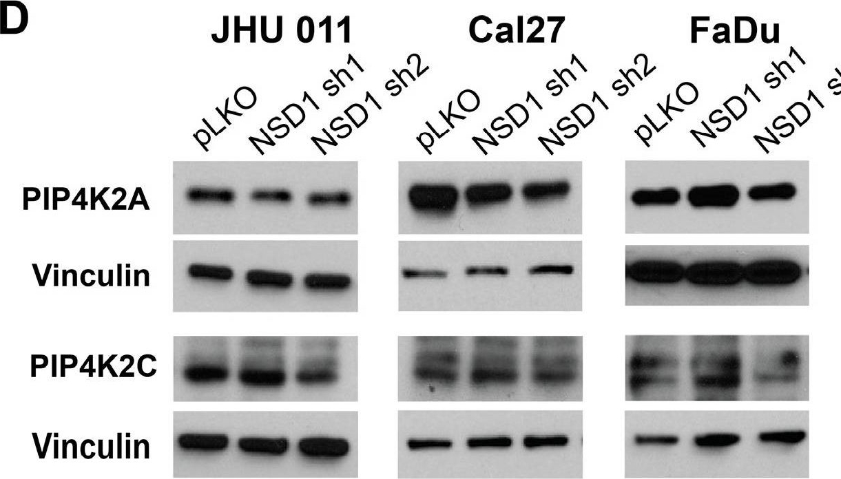 Fig.1.D showing Western Blotting in a Homo sapiens (Human) sample from the publication: PIP4K2B Protein Regulation by NSD1 in HPV-Negative Head and Neck Squamous Cell Carcinoma.