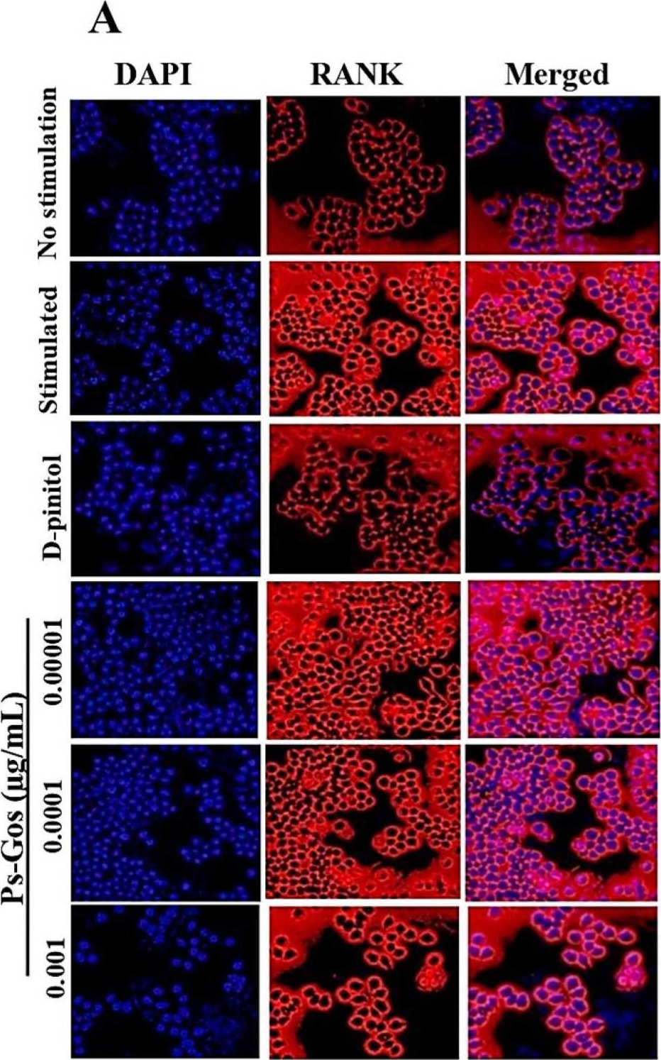 Fig.6.A showing Immunocytochemistry-immunofluorescence in a Mus musculus (House mouse) sample from the publication: Pleurotus sajor-caju (Fr.) Singer β-1,3-Glucanoligosaccharide (Ps-GOS) Suppresses RANKL-Induced Osteoclast Differentiation and Function in Pre-Osteoclastic RAW 264.7 Cells by Inhibiting the RANK/NFκB/cFOS/NFATc1 Signalling Pathway.