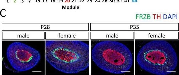 Fig.5.C showing Immunohistochemistry-immunofluorescence in a Mus musculus (House mouse) sample from the publication: The Transcriptome Trajectory Reveals Sex- and Age-Dependent Changes in the Mouse Adrenal Gland.