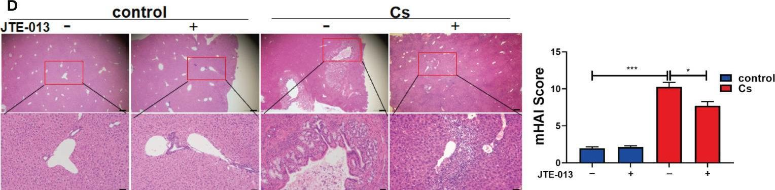 Fig.4.D showing Immunohistochemistry from the publication: Clonorchis sinensis infection induces hepatobiliary injury via disturbing sphingolipid metabolism and activating sphingosine 1-phosphate receptor 2.
