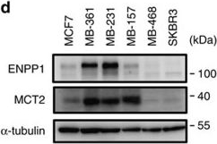 Fig.2.D showing Western Blotting in a Homo sapiens (Human) sample from the publication: Adipocytes promote malignant growth of breast tumours with monocarboxylate transporter 2 expression via β-hydroxybutyrate.