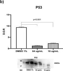 Fig.7.B showing Western Blotting in a Homo sapiens (Human) sample from the publication: Exploring the Bioactive Potential and Chemical Profile of Schinus molle Essential Oil: An Integrated In Silico and In Vitro Evaluation.