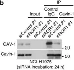 Fig.7.B showing Western Blotting in a Homo sapiens (Human) sample from the publication: ROR1 sustains caveolae and survival signalling as a scaffold of cavin-1 and caveolin-1.