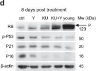 Fig.5.D showing Western Blotting from the publication: Co-inhibition of ATM and ROCK synergistically improves cell proliferation in replicative senescence by activating FOXM1 and E2F1.
