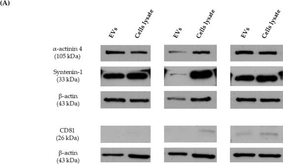 Fig.2.A showing Western Blotting from the publication: A Minimally Invasive, Extracellular Vesicle-Based Approach for Monitoring Measurable Residual Disease in Acute Myeloid Leukemia: A Proof-of-Concept Study.