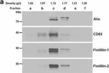 Fig.1.A showing Western Blotting from the publication: Enhanced exosome secretion in Down syndrome brain - a protective mechanism to alleviate neuronal endosomal abnormalities.