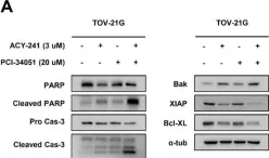 Fig.3.A showing Western Blotting from the publication: HDAC8-Selective Inhibition by PCI-34051 Enhances the Anticancer Effects of ACY-241 in Ovarian Cancer Cells.