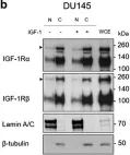 Fig.1.B showing Western Blotting in a Homo sapiens (Human) sample from the publication: IGF-1R nuclear import and recruitment to chromatin involves both alpha and beta subunits.