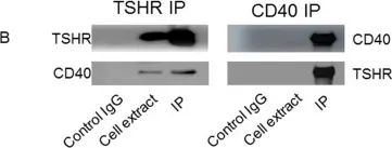 Fig.6.B showing Western Blotting in a Homo sapiens (Human) sample from the publication: CD40 Expression in Fibrocytes Is Induced by TSH: Potential Synergistic Immune Activation.