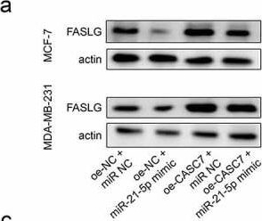 Fig.5.A showing Western Blotting from the publication: Long non-coding RNA CASC7 suppresses malignant behaviors of breast cancer by regulating miR-21-5p/FASLG axis.