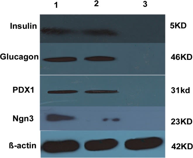 Fig.8.A showing Western Blotting in a Homo sapiens (Human) sample from the publication: The Generation of Insulin Producing Cells from Human Mesenchymal Stem Cells by MiR-375 and Anti-MiR-9.