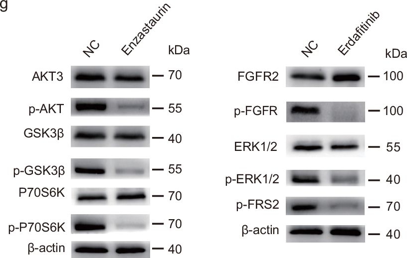 Fig.3.G showing Western Blotting from the publication: Single-cell analysis reveals transcriptomic features and therapeutic targets in primary pulmonary lymphoepithelioma-like carcinoma.