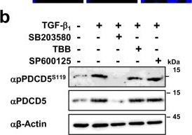 Fig.4.B showing Western Blotting from the publication: Club cell-specific role of programmed cell death 5 in pulmonary fibrosis.