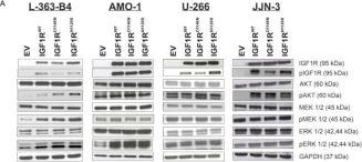 Phospho-IGF-I Receptor beta (Tyr1135) (DA7A8) Rabbit Monoclonal